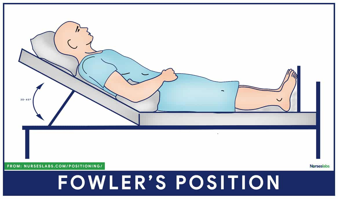 1.Fowler’s position