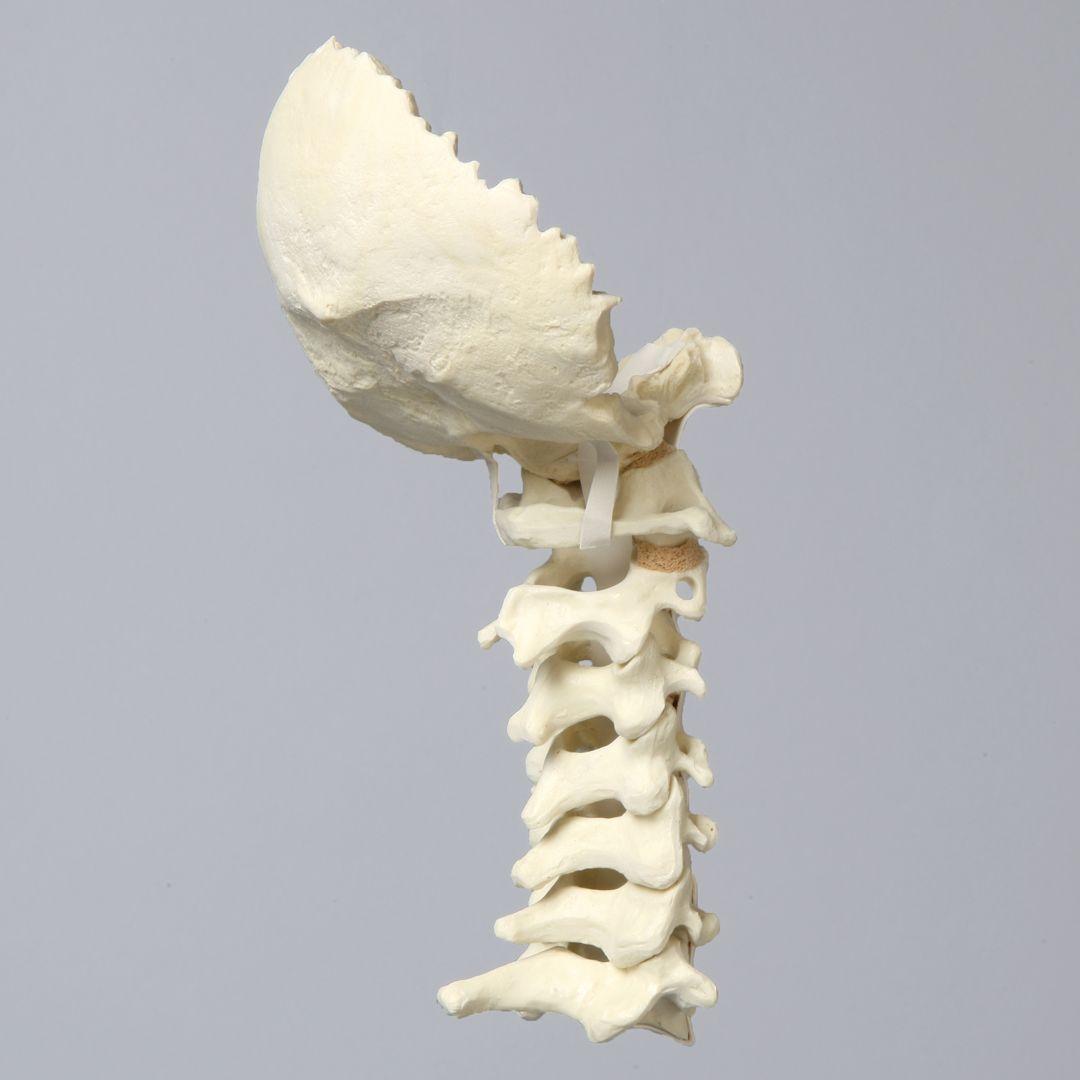Cervical Spine and Occipital Bone Model
