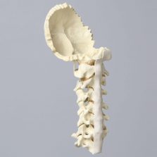FlexBone spine models for surgical and patient education