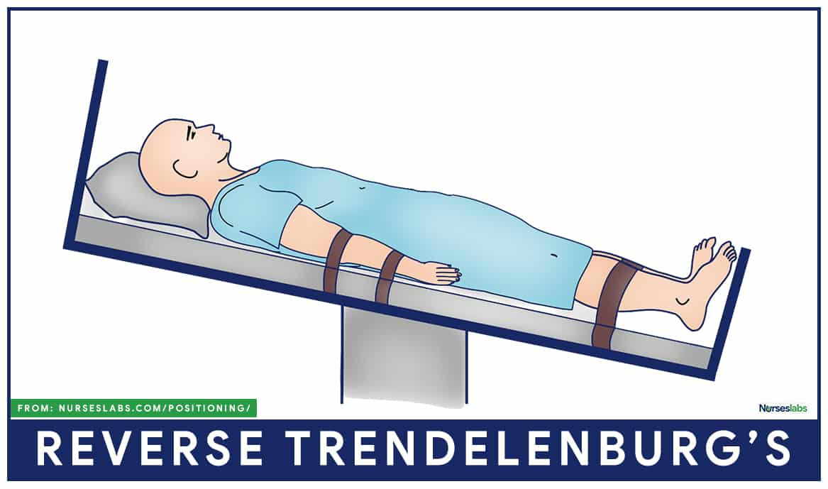 Reverse Trendelenburg Position